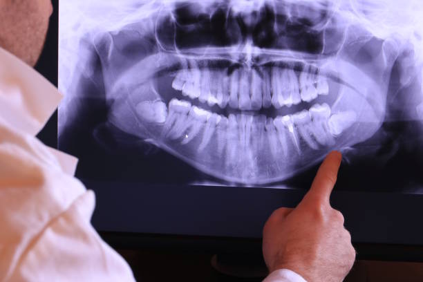 Best Orthodontic Emergency Dentist in St Gabriel, LA